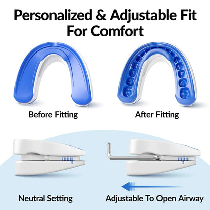 Elite™ Anti-Snoring Mouth Guard